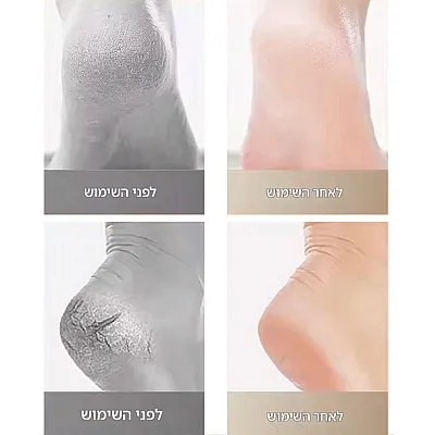 גרביי עקב עם סיליקון לעור יבש וסדוק